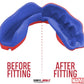 Marvel Spider Man Mouthguard