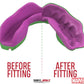 Marvel Hulk Mouthguard