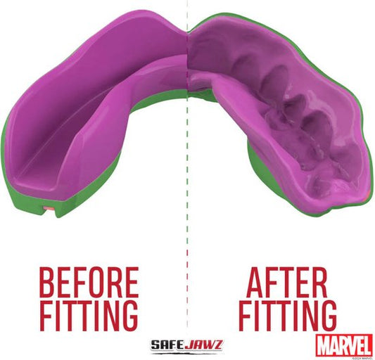 Marvel Hulk Mouthguard