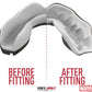 Marvel Venom Mouthguard